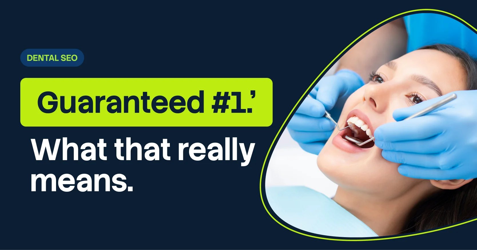 Guaranteed SEO for Dentists: Is it Real or Just a Sales Pitch?